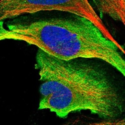 HYLS1 Antibody, Novus Biologicals 0.1mL; Unlabeled:Antibodies, Polyclonal